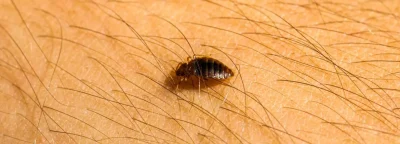 Bed bugs crawling on skin surface