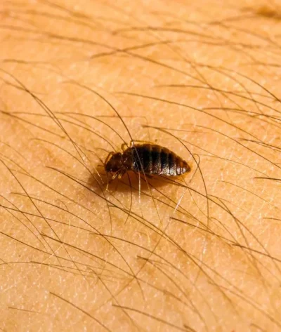 Bed bugs crawling on skin surface